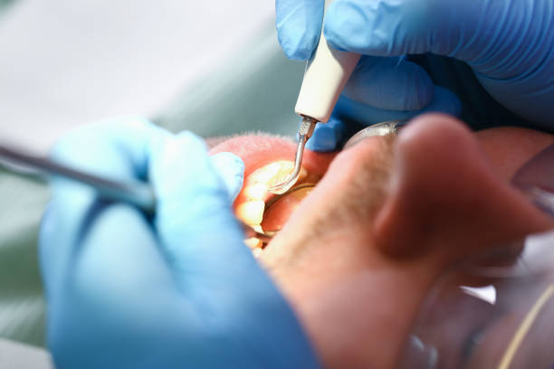 Best Weekend Emergency Dentist in Center Point, NM